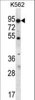 Polyclonal Rabbit anti-Human ABCD2 / ALDR Antibody (aa553-582, IHC, WB)