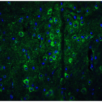 IHC-plus™ GPAM Antibody