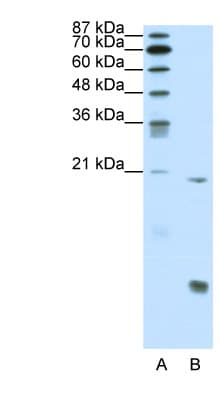 AML1 / RUNX1 Antibody (N-Terminus)