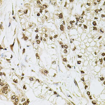 CREBBP / CREB Binding Protein Antibody