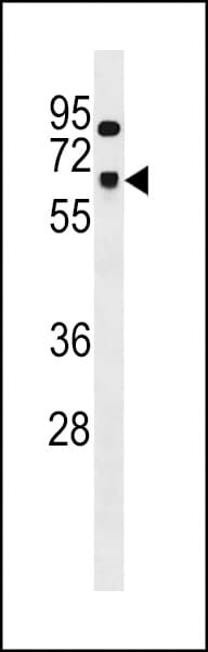 SNRP70 / SNRNP70 Antibody (aa195-223)