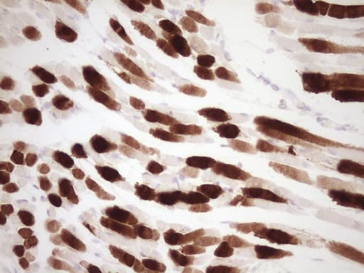 Monoclonal Mouse anti-Human TNNI3 / Cardiac Troponin I Antibody (clone OTI3H9, IHC, WB)