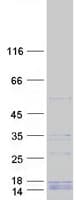 Human ERI1 / HEXO Protein (Recombinant Myc-DDK (Flag))