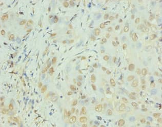 IL8 / Interleukin 8 Antibody