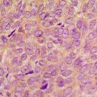 VAV2 Antibody (N-Terminus)
