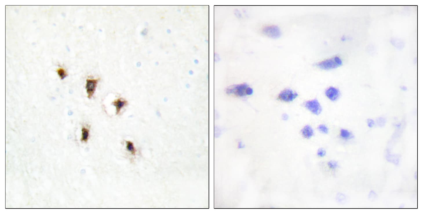 MVK Antibody (aa151-200)