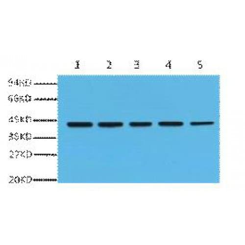 Monoclonal Mouse anti-Human ACTB / Beta Actin Antibody (clone 5B7, C-term, IHC, WB)