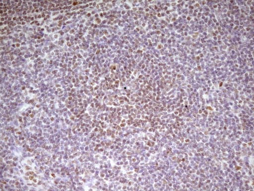 Monoclonal Mouse anti-Human SP110 Antibody (clone OTI4C1, aa232-521, IHC, WB)
