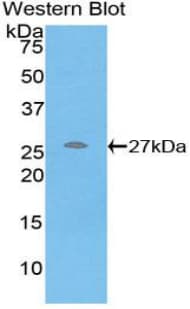 CRP / C-Reactive Protein Antibody (aa20-230)