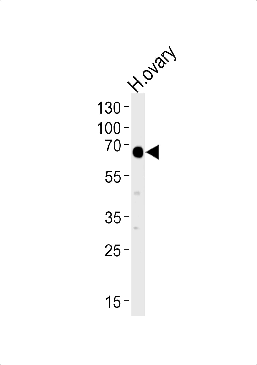 Polyclonal Rabbit anti-Human POTEB3 / POTE-15 Antibody (aa381-410, IHC, WB)