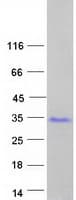 Human GAGE2B Protein (Recombinant Myc-DDK (Flag))