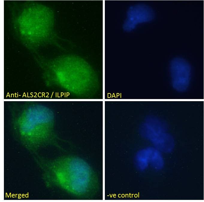 IHC-plus™ STRADB / ALS2CR2 Antibody (aa406-418)