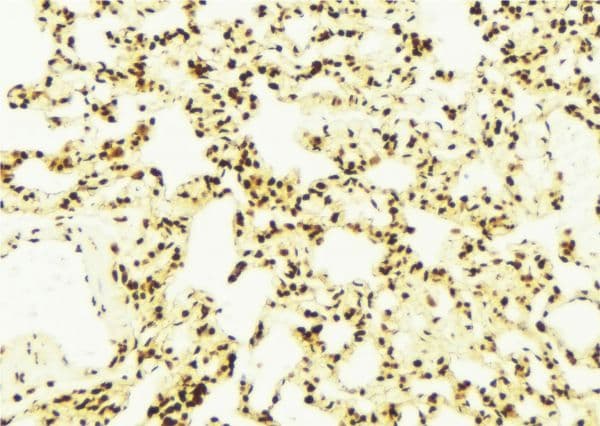 DNAJA1 / HDJ2 Antibody