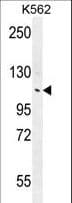 Polyclonal Rabbit anti-Human ANKRD18B Antibody (aa274-302, IHC, WB)