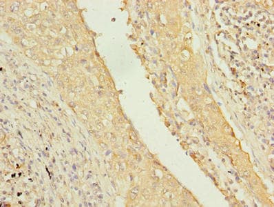 TMEM55A Antibody