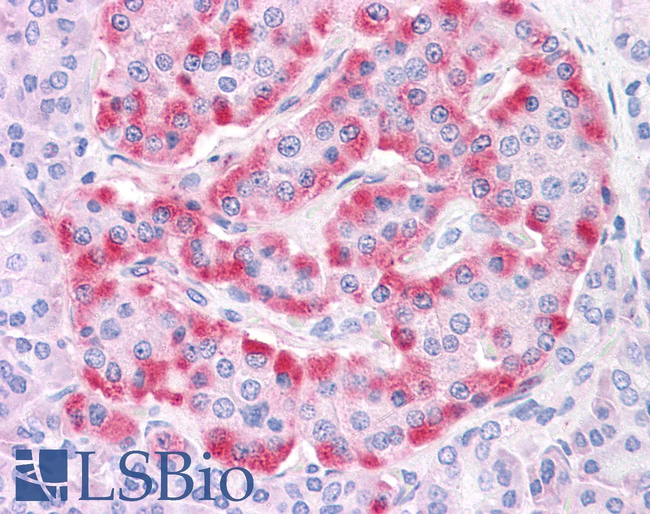 IHC-plus™ Polyclonal Rabbit anti-Human TM9SF4 Antibody (Internal, IHC)
