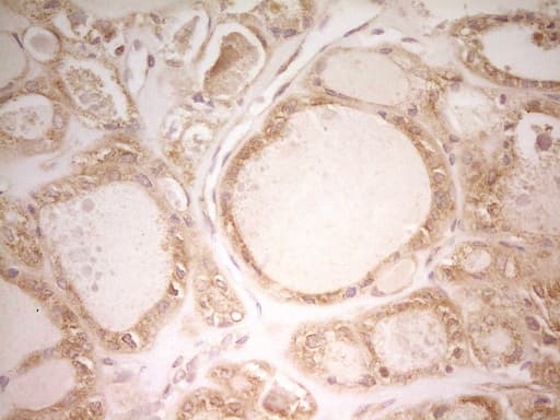 Monoclonal Mouse anti-Human PAK4 Antibody (clone OTI1C7, aa1-308, IHC, WB)
