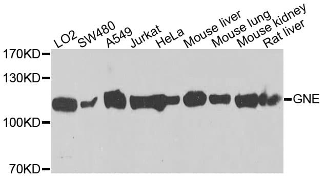 GLCNE / GNE Antibody