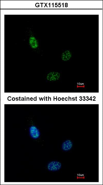 CLP1 Antibody (aa142-371)