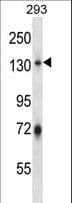 RNF20 Antibody (aa117-146)