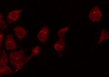 RAPGEF3 / EPAC Antibody