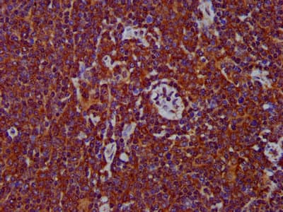 Polyclonal Rabbit anti-Human ADAM8 Antibody (IHC, IF, WB)