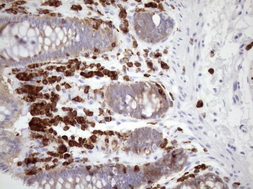URP2 / FERMT3 Antibody (aa259-528, clone OTI3C7)