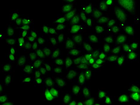 Polyclonal Rabbit anti-Human NFYB Antibody (IHC, IF, WB)