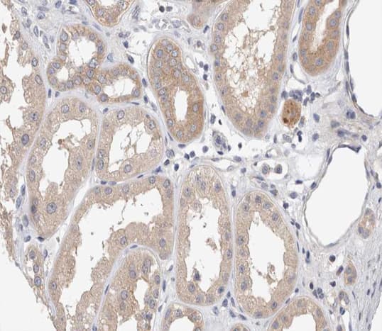 APP / Beta Amyloid Precursor Antibody (phospho-Thr743,pThr668)