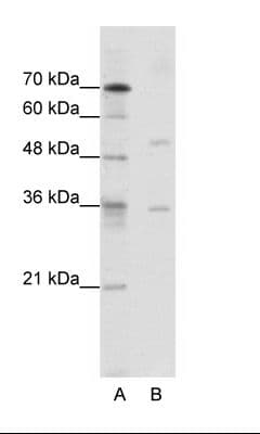 DATF1 / DIDO1 Antibody (aa72-121)