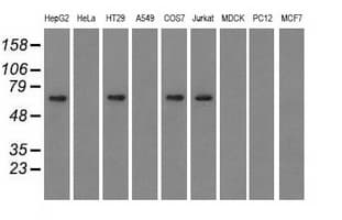IGF2BP2 Antibody (clone OTI5G3)