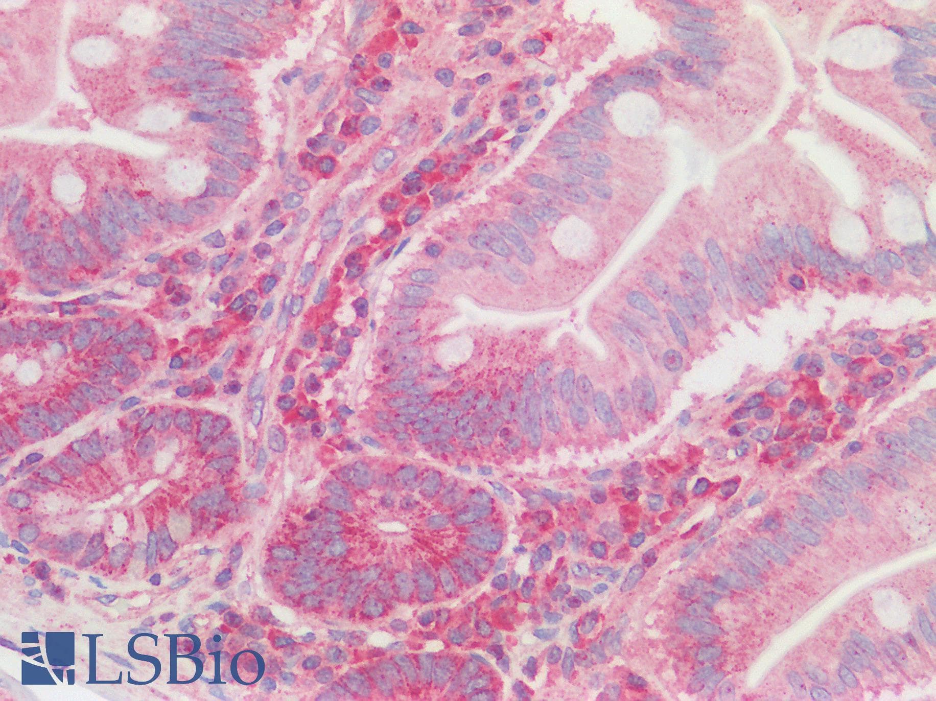 IHC-plus™ CNOT3 Antibody (aa525-575)