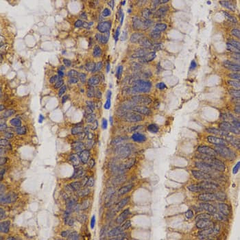 MMP25 / Leukolysin Antibody