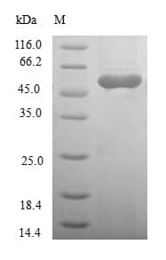 Human RASSF5 / RAPL Protein (Recombinant GST, N-terminus)