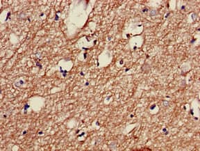 TH / Tyrosine Hydroxylase Antibody (aa2-197)