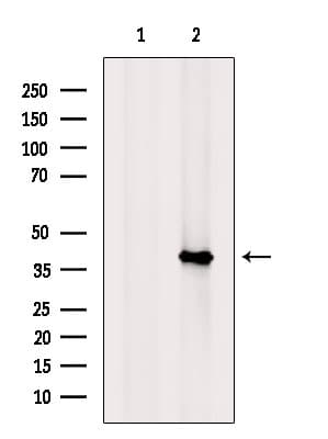 RSPO3 Antibody
