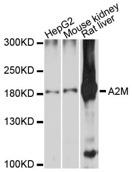 Polyclonal Rabbit anti-Human A2M / Alpha-2-Macroglobulin Antibody (IHC, WB)