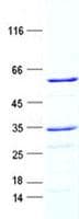 Human DNASE1 / DNase I Protein (Recombinant GST, N-terminus + His, C-terminus)