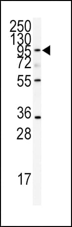 ADAMTS13 Antibody (aa829-858)