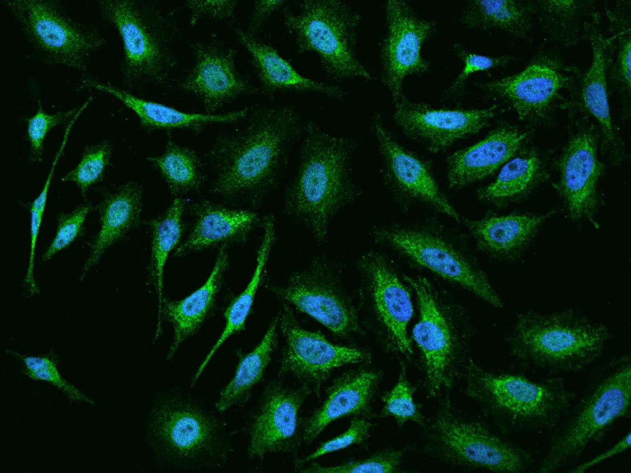 UQCRC1 Antibody