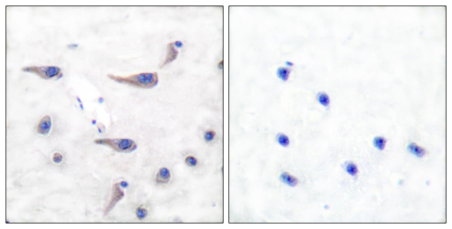 MARCKS Antibody (phospho-Ser163)