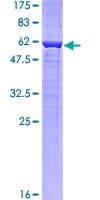Human PRR16 Protein (Recombinant GST)