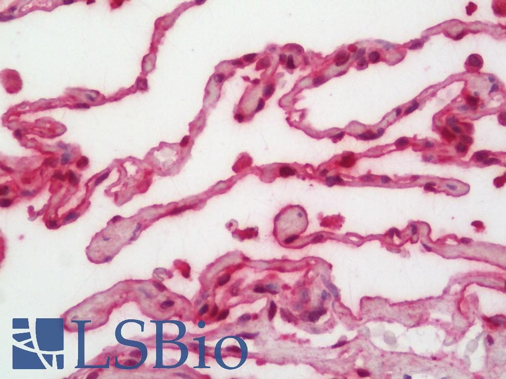 ANXA3 / Annexin A3 Antibody (FITC)