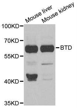 BTD / Biotinidase Antibody