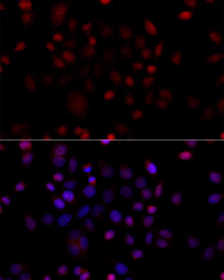 Polyclonal Rabbit anti-Human VDAC1 / PORIN Antibody (aa1-283, IHC, IF, WB)
