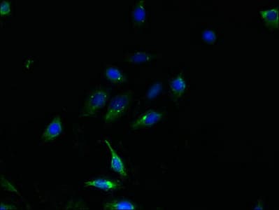 TMEM159 Antibody (aa1-54)
