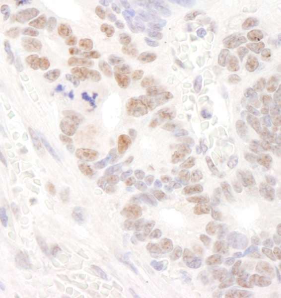 Polyclonal Rabbit anti-Human DDX24 Antibody (aa800-C-term, IHC, WB)