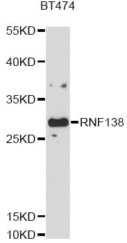 Polyclonal Rabbit anti-Mouse RNF138 Antibody (WB)
