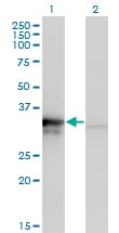 BM022 / MRPL1 Antibody (clone 2C4)