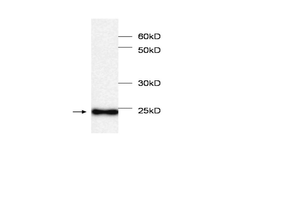 Monoclonal Mouse anti-Human MB / Myoglobin Antibody (WB)